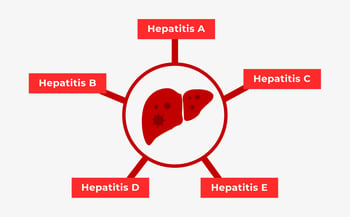 Hepatitis - Ursachen, Symptome und Behandlung von Leberentzündungen