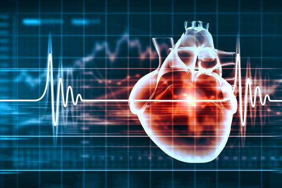Stress und Atherosklerose: Wie Stress das Herz-Kreislauf-System beeinflussen kann