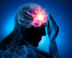 Doppelt belastet - Migräne und der Zusammenhang mit psychischen Störungen